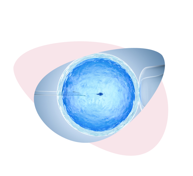 IVF léčba s darovanými vajíčky